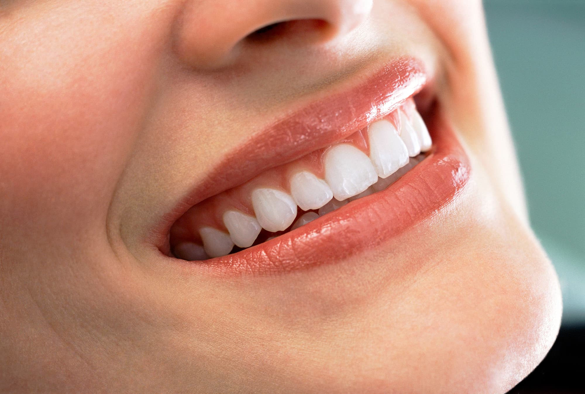 Smile Designing treatment procedure